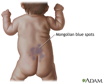 Mongolian Blue Spot